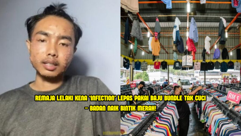 ‘Satu Badan Naik Bintik Merah’ – Lelaki Menyesal Pakai Baju Bundle Tanpa Cuci