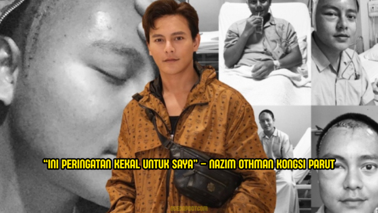 Nazim Othman Dedah Parut Pembedahan Otak Masih Kekal